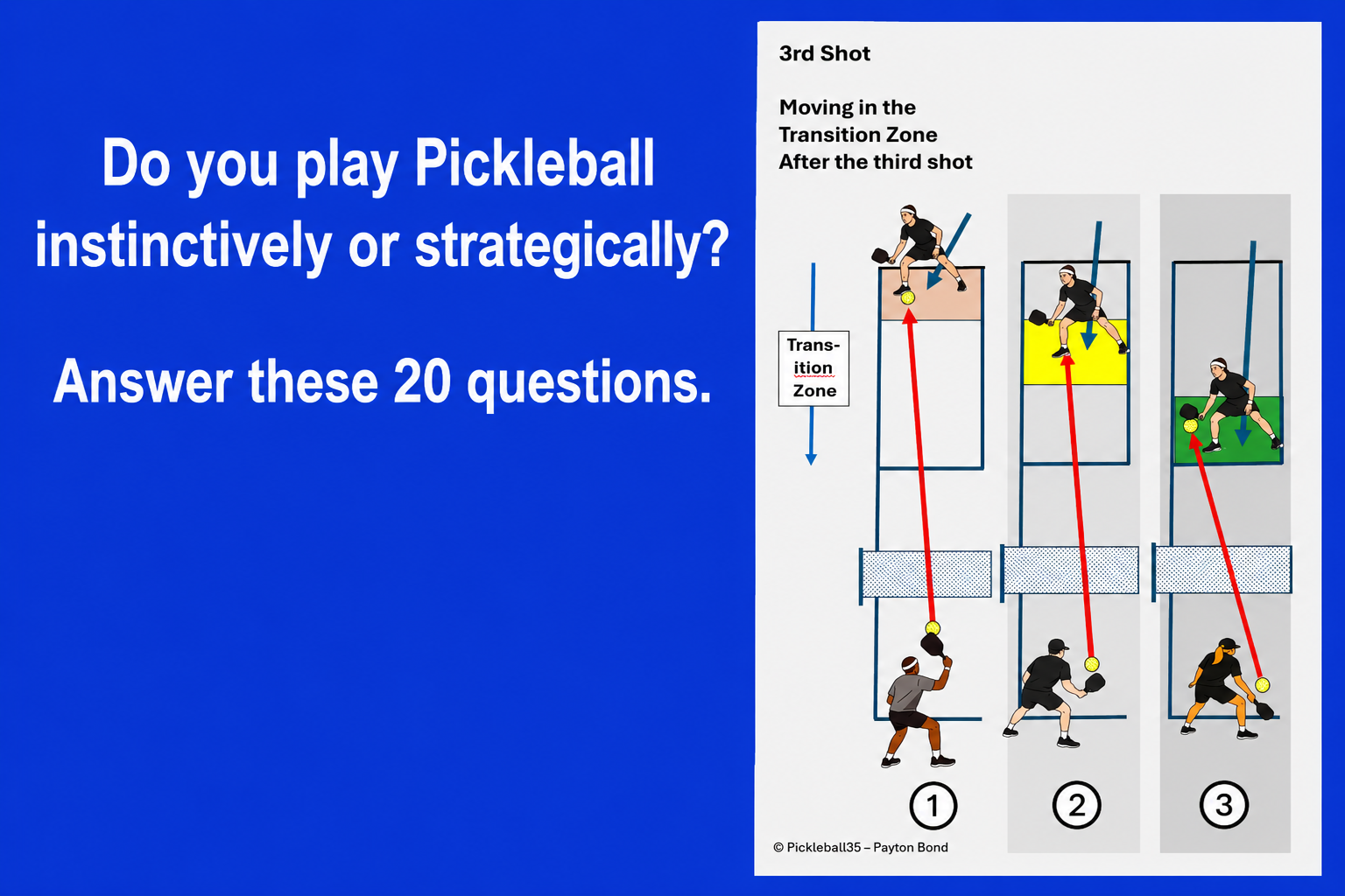 Do you play pickleball instinctively or strategically? Answer these 20 questions.